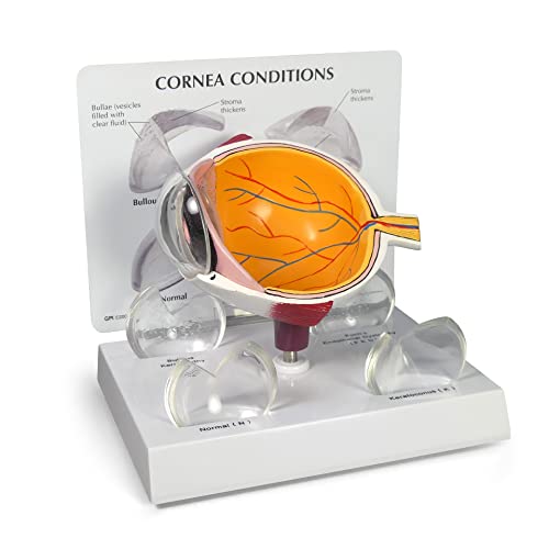 GPI Anatomicals 2780 Auge Modell Hornhaut von GPI Anatomicals