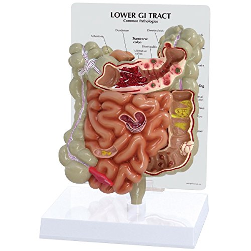 GPI Anatomicals 3342 Magen-Darm Trakt Modell, 1019556 GPI Anatomicals 3342 Magen-Darm Trakt Modell, 1019556 von 3B Scientific