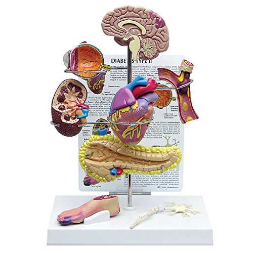 GPI Anatomicals W33386 Diabetes Modell, mini Set, 4 Stück von GPI Anatomicals