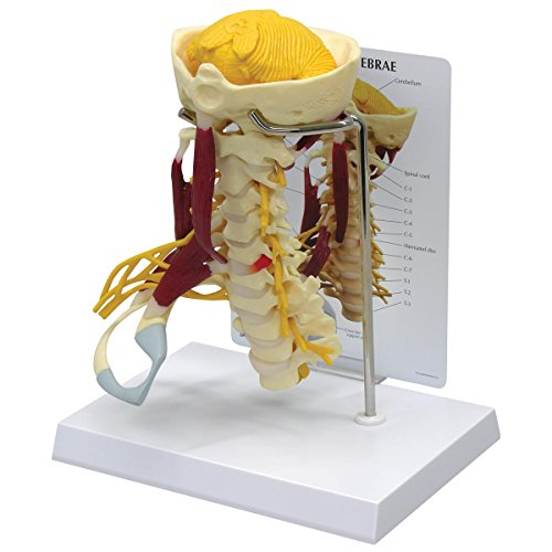 GPI Anatomicals W47853 Halswirbel Muskeln Modell GPI Anatomicals W47853 Halswirbel Muskeln Modell von 3B Scientific