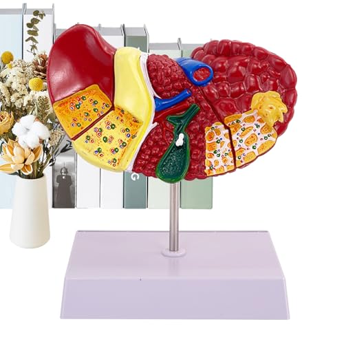 Modell des menschlichen Leberanatomie - Modell der Textur Leber Pathologie für Medizinstudenten und Ärzte | Perfekt für wissenschaftliche Forschung und Krankenhäuser, ideal für Unterrichtsausst Modell des menschlichen Leberanatomie - Modell der Textur Leber Pathologie für Medizinstudenten und Ärzte | Perfekt für wissenschaftliche Forschung und Krankenhäuser, ideal für Unterrichtsausst von Generisch