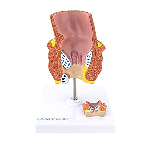 HeineScientific Hämorrhoiden-Modell HeineScientific Hämorrhoiden-Modell von HeineScientific