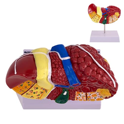 Anatomisches Modell Der Leber,Lebermodell - Anatomisches Pathologiemodell Mit Klarer Textur Zur Anzeige - Anatomisches Display, Vielseitige Modellschule Der Menschlichen Leber Für Wissenschaftliche Fo Anatomisches Modell Der Leber,Lebermodell - Anatomisches Pathologiemodell Mit Klarer Textur Zur Anzeige - Anatomisches Display, Vielseitige Modellschule Der Menschlichen Leber Für Wissenschaftliche Fo von Jlobnyiun