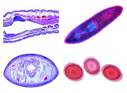 LIEDER Biologie Mikroskopie Mikropräparate Serien_ Schwämme und Hohltiere (Coelenterata, Porifera) von LIEDER