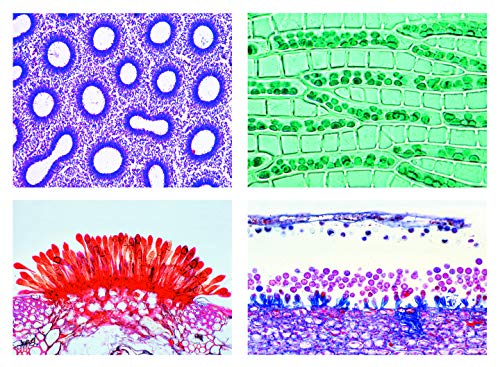 LIEDER Biologie Mikroskopie Mikropräparate Serien: Blütenlose Pflanzen (Cryptogamae), Ergänzungsserie I, 25 Präparate, Erweiterung der Serie 2600 von LIEDER