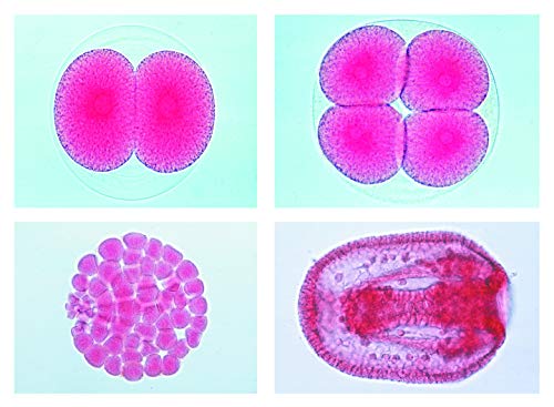 LIEDER Biologie Mikroskopie Mikropräparate Serien: Entwicklung des Seeigels (Psammechinus miliaris), 12 Präparate von LIEDER