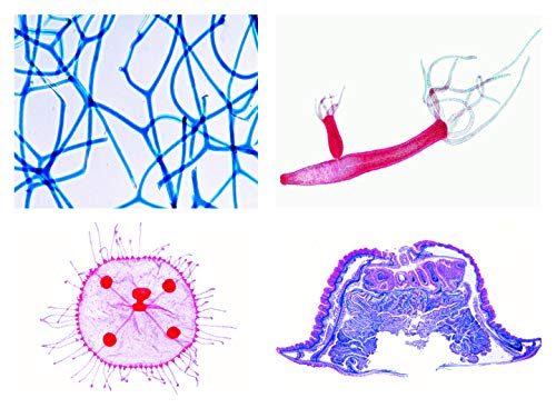 LIEDER Biologie Mikroskopie Mikropräparate Serien: Schwämme und Hohltiere (Coelenterata, Porifera), neue erweiterte Serie, 10 Präparate von LIEDER