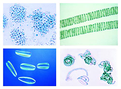 LIEDER Biologie Mikroskopie Mikropräparate Serien: Unsere Umwelt II. Das Wasser, Die Gewässerverschmutzung, Ursachen und Kennzeichen, 20 Präparate von LIEDER