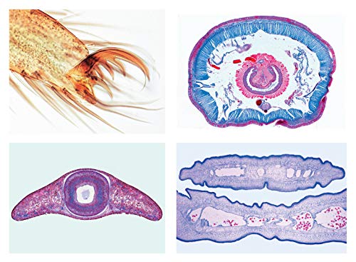 LIEDER Mikropräparat Serie: Wirbellose Tiere (Invertebrata), Grundserie - 25 Präparate von LIEDER