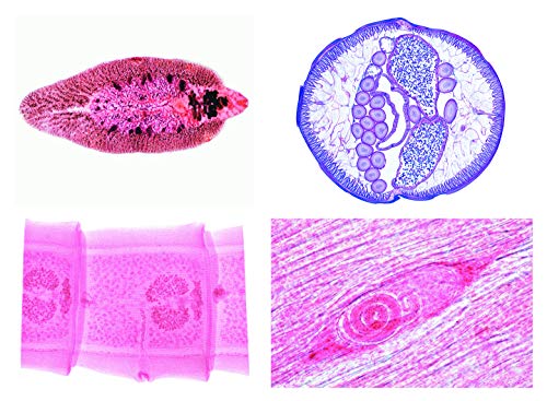 LIEDER Serie - Parasitologie von LIEDER