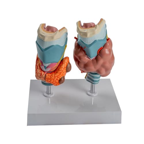 Anatomisches pathologisches Schilddrüsenmodell mit abnehmbarem Teil, pathologisches Schilddrüsen-Klarynx-Anatomie-Modell für pädagogische Nutzung Anatomisches pathologisches Schilddrüsenmodell mit abnehmbarem Teil, pathologisches Schilddrüsen-Klarynx-Anatomie-Modell für pädagogische Nutzung von LLINthy