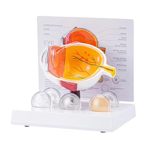 Anatomische Pathologische Augapfel Modell Unterrichts Werkzeuganatomie Anatomie Anatomie Anatomie Anatomie Modell Anatomische Pathologische Augapfel Modell Unterrichts Werkzeuganatomie Anatomie Anatomie Anatomie Anatomie Modell von Lerpwige