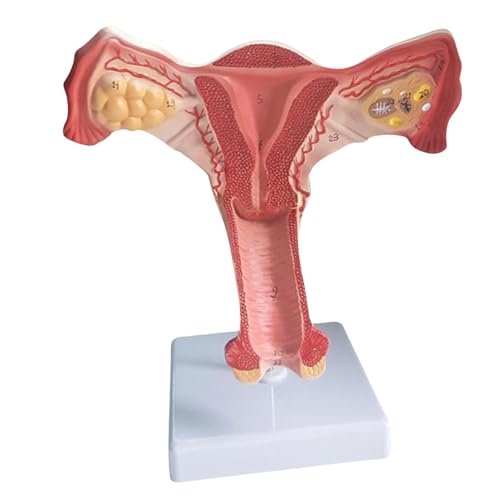 Weibliche Becken Anatomie Model Unterrichts Lehrwerkzeug Anatomischer Weiblicher Genital Und Eierstockmodell Für Demonstrationen Vortrag Weibliche Becken Anatomie Model Unterrichts Lehrwerkzeug Anatomischer Weiblicher Genital Und Eierstockmodell Für Demonstrationen Vortrag von Lerpwige