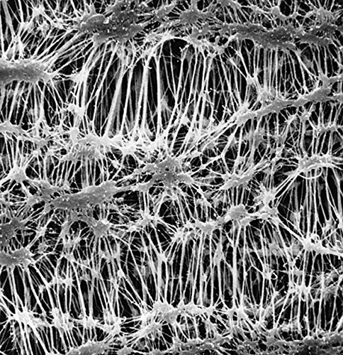 MILLIPORE 051810 Filtre membrane Omnipore porosité 10 µm (Pack de 100) von Millipore
