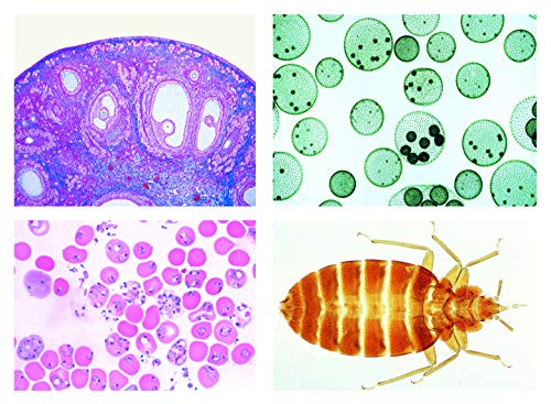 LIEDER Biologie Mikroskopie Mikropräparate Serien: Schulserie C (Ergänzung zu A und B). 50 Präparate von Philips Domestic Appliances