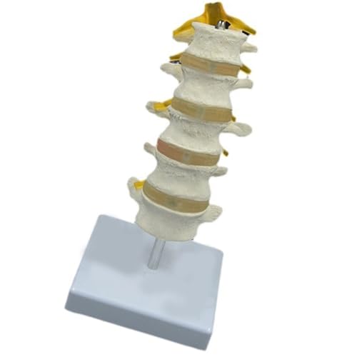 Fünf Segmentlumbalwirbelsäulenmodell Menschliches Anatomisches Lendenwirbelsäulenmodell Pathologischer Lendenwirbelsäule Anatomie Modell Für Forschung von Prmaylis