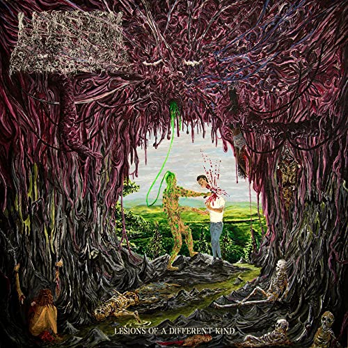 Lesions of a Different Kind von Prosthetic Records / Cargo