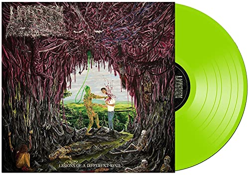 Lesions Of A Different Kind [Vinyl LP] von Prosthetic Records