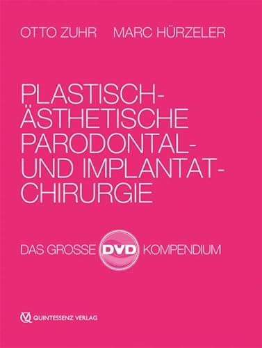 Plastisch-ästhetische Parodontal- und Implantatchirurgie: Das große DVD-Kompendium Plastisch-ästhetische Parodontal- und Implantatchirurgie: Das große DVD-Kompendium von Quintessenz Verlags-GmbH