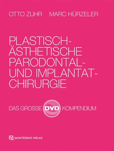 Plastisch-ästhetische Parodontal- und Implantatchirurgie: Das große DVD-Kompendium von Quintessenz Verlags-GmbH