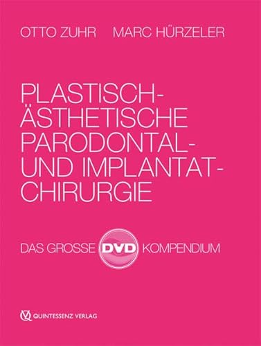 Plastisch-ästhetische Parodontal- und Implantatchirurgie: Das große DVD-Kompendium von Quintessenz Verlags-GmbH