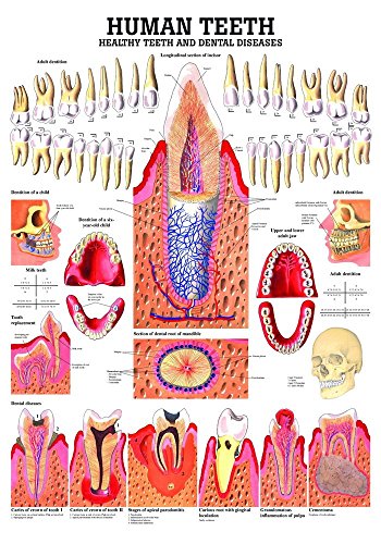 Ruediger Anatomie CH01LAM Healthy and Diseased Teeth Tafel, englisch, 70 cm x 100 cm, laminiert von Rdiger- Anatomie GmbH