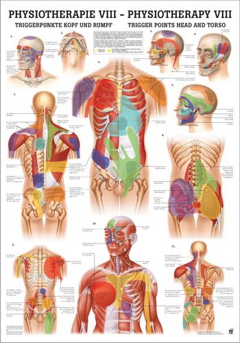 Ruediger Anatomie PHYS VIII LAM Triggerpunkte Kopf und Rumpf Tafel, 50 cm x 70 cm, laminiert von Rdiger- Anatomie GmbH