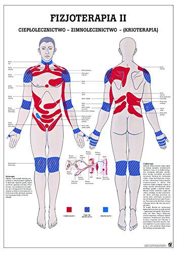 Ruediger Anatomie PL_PHYS2 Cieplolecznictwo-Zimnolecznictwo-Krioterapia Tafel, polnisch, 70 cm x 100 cm, Papier von Rdiger- Anatomie GmbH