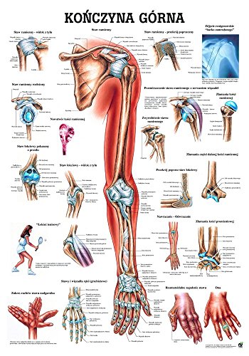 Ruediger Anatomie PL13 Konczyna Górna Tafel, polnisch, 70 cm x 100 cm, Papier von Rdiger- Anatomie GmbH