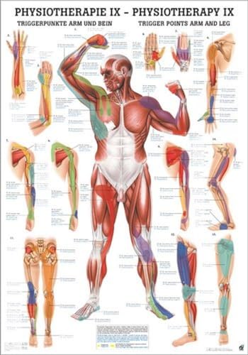 Triggerpunkte I Arm & Bein. 50x70 cm: Trigger Points Arm and Leg von Rdiger- Anatomie GmbH