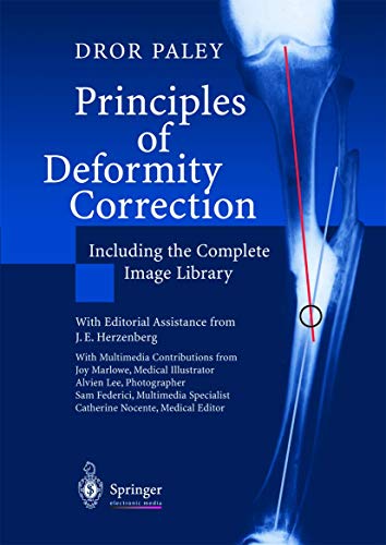 Principles of Deformity Correction, 1 CD-ROM: Exercise Workbook. With a completely downloadable image library Principles of Deformity Correction, 1 CD-ROM: Exercise Workbook. With a completely downloadable image library von Springer