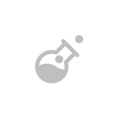 Vitlab Polypropylen Erlenmeyer-Kolben mit Schraubkappe, Weithals, Transparent, GL 45 Gewinde, 75ml Kapazität, 6 Stück Vitlab Polypropylen Erlenmeyer-Kolben mit Schraubkappe, Weithals, Transparent, GL 45 Gewinde, 75ml Kapazität, 6 Stück von Vitlab