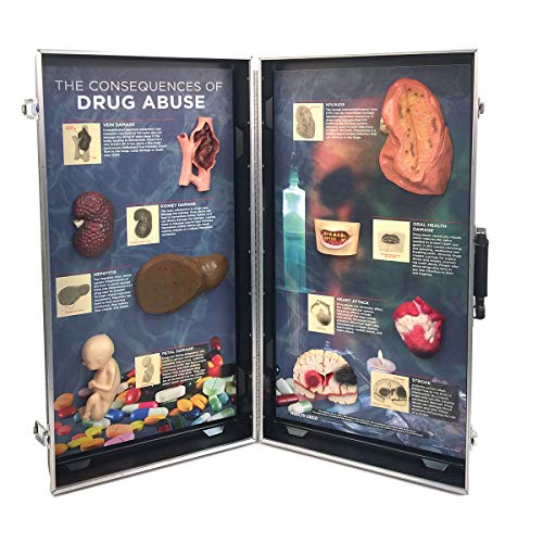 WRS Group „Die Folgen des Drogenmissbrauchs“, 3D Schautafel von WRS Group
