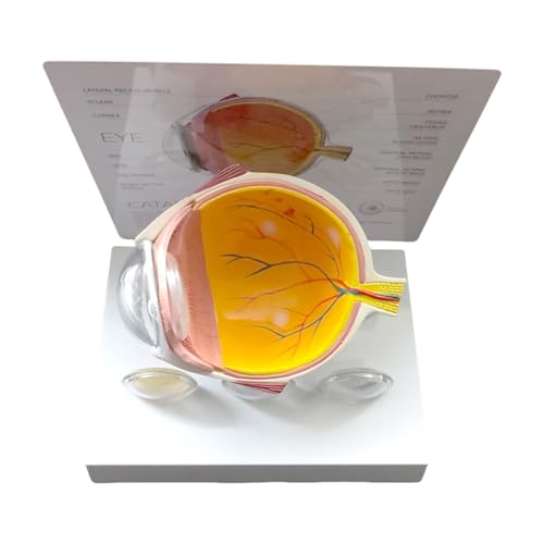 Realistisches menschliches Auge, Anatomie-Modell, anatomisches Augapfelmodell, Lehrwerkzeug, pathologisches Augapfel-Anatomie-Modell für den Unterricht Realistisches menschliches Auge, Anatomie-Modell, anatomisches Augapfelmodell, Lehrwerkzeug, pathologisches Augapfel-Anatomie-Modell für den Unterricht von XIAOQENAN