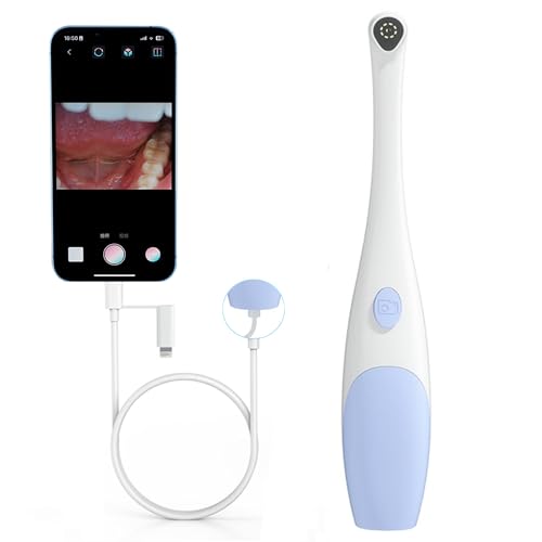 Oral-Endoskop,1920P HD Oralkamera, Video-Tierzahninspektion, Intraorale Kamera mit 8 verstellbare LED-Leuchten, kompatibel mit Android und iOS, iPhone, für Einzelpersonen und Haustiere Plug-and-Play von Yiko