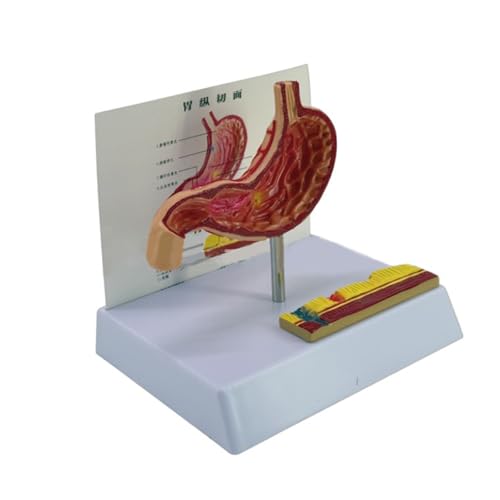 Anatomisches Magenperforationsmodell Pathologische Magenanatomie Modell für Unterricht Demonstration und pädagogische Bildung von ZWTPGKRD