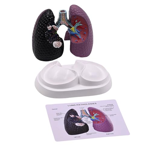 Anatomisches Lungenmodell für normale und pathologische Lungenanatomie, Modell für klinische Einstellungen, Lehr- und Vorlesungsbericht Anatomisches Lungenmodell für normale und pathologische Lungenanatomie, Modell für klinische Einstellungen, Lehr- und Vorlesungsbericht von ZYKEJJDDAK
