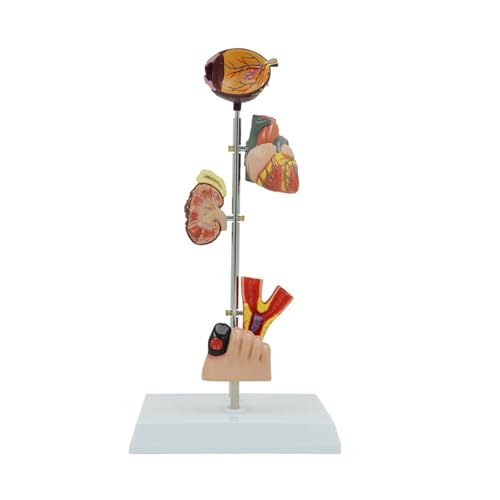 Anatomisches pathologisches Nierenmodell, Pathologie, Demonstration, Anatomie-Modell, menschliche Niere, Blutgefäßmodell von Zqxnt