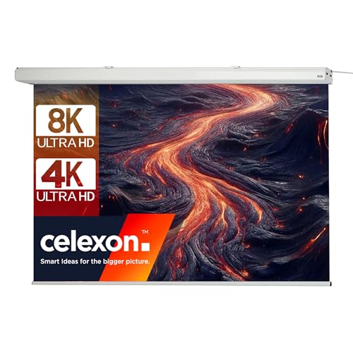 celexon Expert Motor-Leinwand 95" | 200x125 cm 16:10 | elektrische 8K, Full-HD Beamer-Leinwand für Ihre Heimkino- oder Büro-Präsentationen | zur Decken- & Wand-Montage | mit Fernbedienung celexon Expert Motor-Leinwand 95" | 200x125 cm 16:10 | elektrische 8K, Full-HD Beamer-Leinwand für Ihre Heimkino- oder Büro-Präsentationen | zur Decken- & Wand-Montage | mit Fernbedienung von celexon
