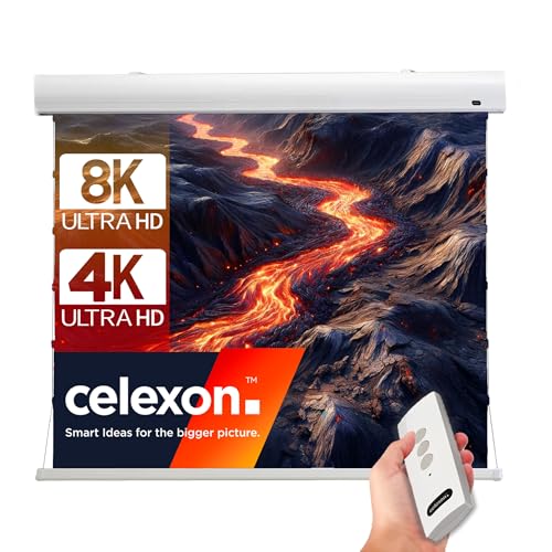 celexon HomeCinema Dynamic Slate ALR Hochkontrast-Tension-Motor-Leinwand 120" | 265x149cm 16:9 | elektrische 8K, Full-HD Beamer-Projektions-Leinwand mit strammen Seilspannsystem | Decken-/Wand-Montage celexon HomeCinema Dynamic Slate ALR Hochkontrast-Tension-Motor-Leinwand 120" | 265x149cm 16:9 | elektrische 8K, Full-HD Beamer-Projektions-Leinwand mit strammen Seilspannsystem | Decken-/Wand-Montage von celexon