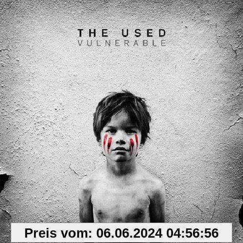 Vulnerable von the Used